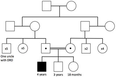 The Interaction of Genetic Mutations in PARK2 and FA2H Causes a Novel Phenotype in a Case of Childhood-Onset Movement Disorder